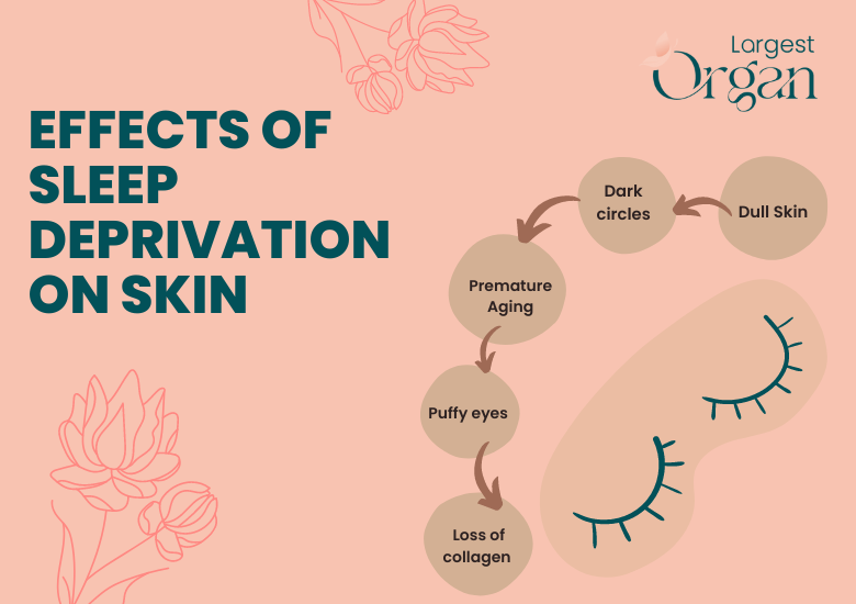 effects-of-sleep-depriviation-on-skin